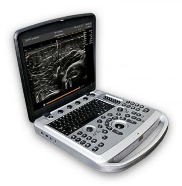 Ecograf color Chison SonoBook 6 laptop de la Sonest Medical
