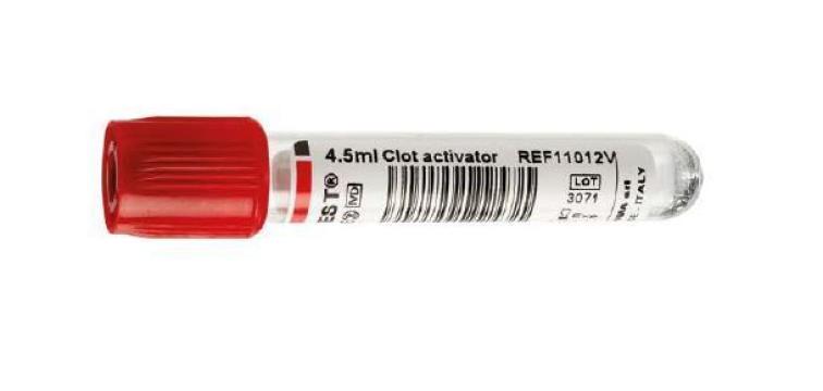 Eprubeta Vacutest Kima - biochimie cu clot activator de la Profi Pentru Sanatate Srl